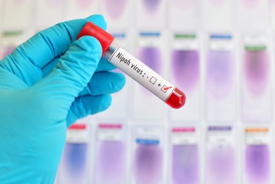 Nipah Vírus tem circulado em países da Ásia desde 1999 (Imagem: Shutterstock)